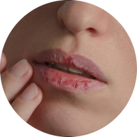 Lip Care